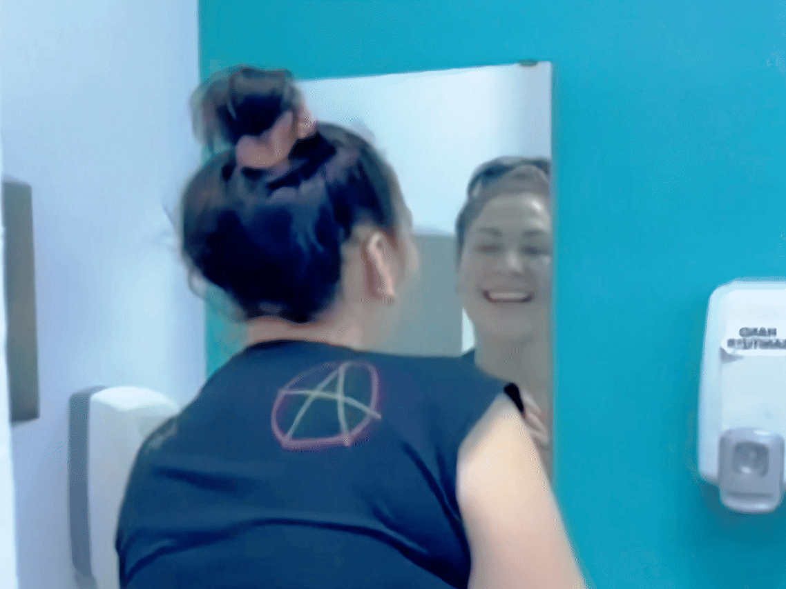 Smile Design with Veneer